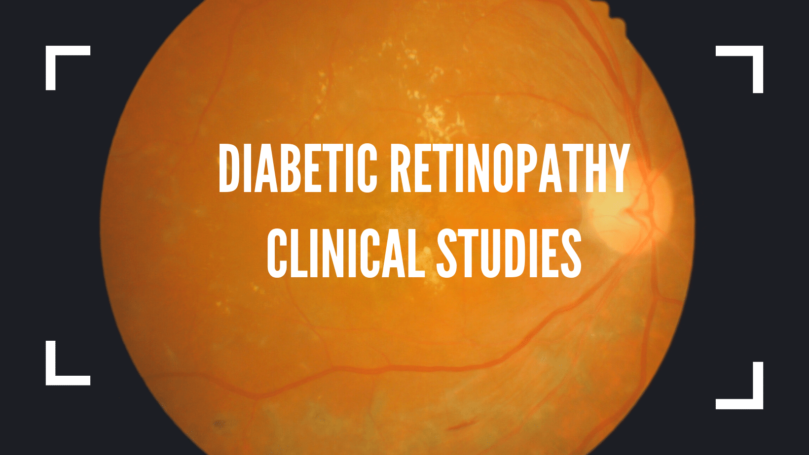 horizons (9) Diabetic Retinopathy Clinical Studies